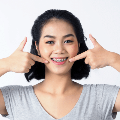 How to clean braces 4 Teenage girl pointing at her braces, representing how to clean braces