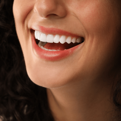 Close-up of a woman's smile, representing orthodontic treatment for adults